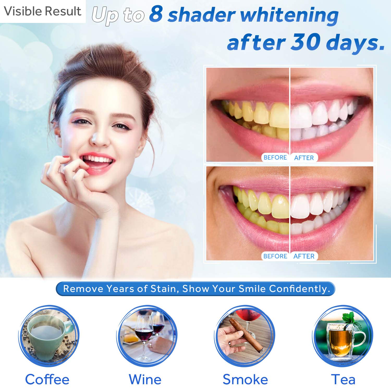 Gel de blanchiment des dents r - Teeth Whitening Near Me avis et prix