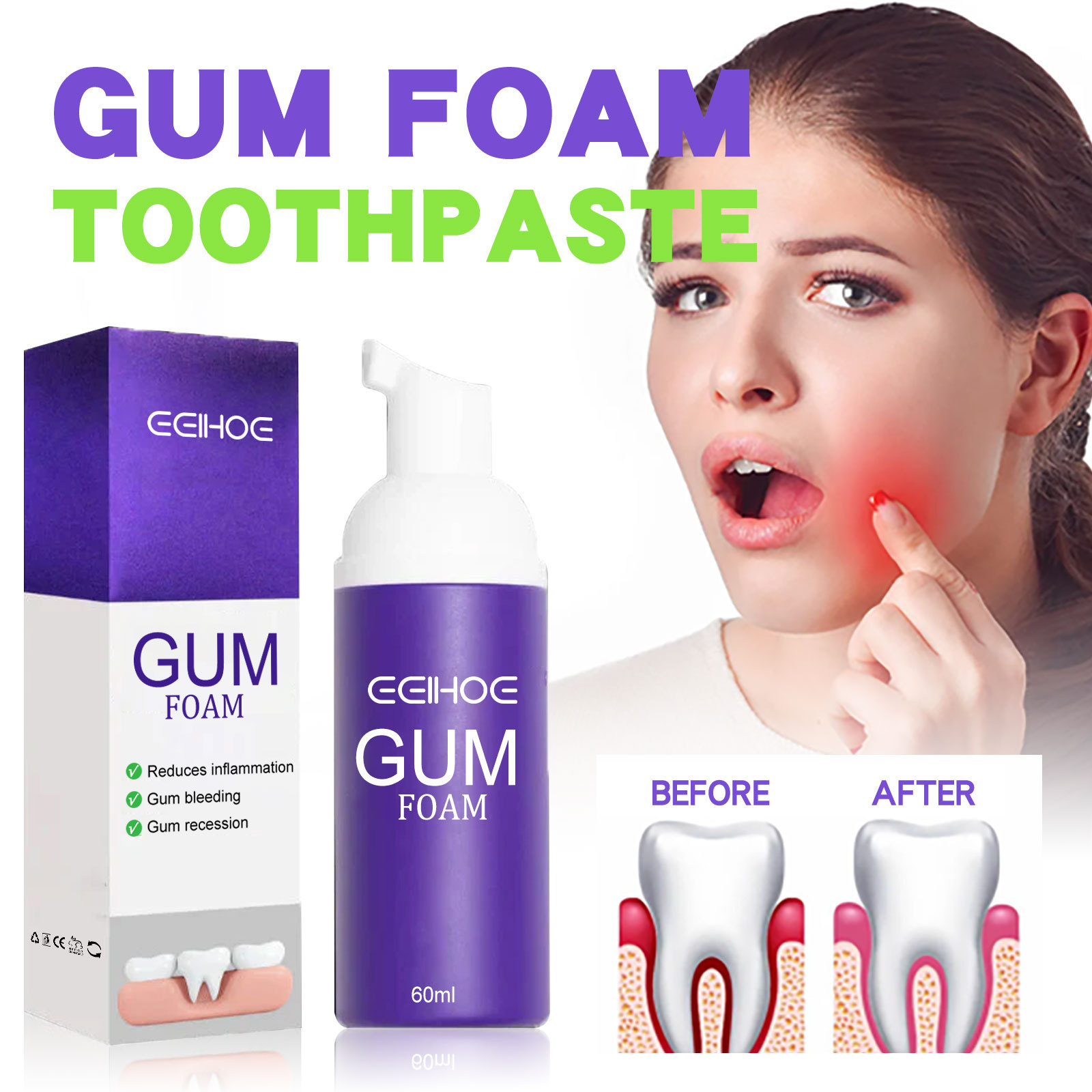 Mousse de blanchiment des dent - Teeth Whitening Pens avis et prix