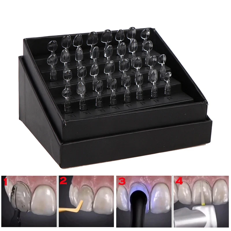 Kit de moule de placage de rés - Teeth Whitening Moulds avis et prix