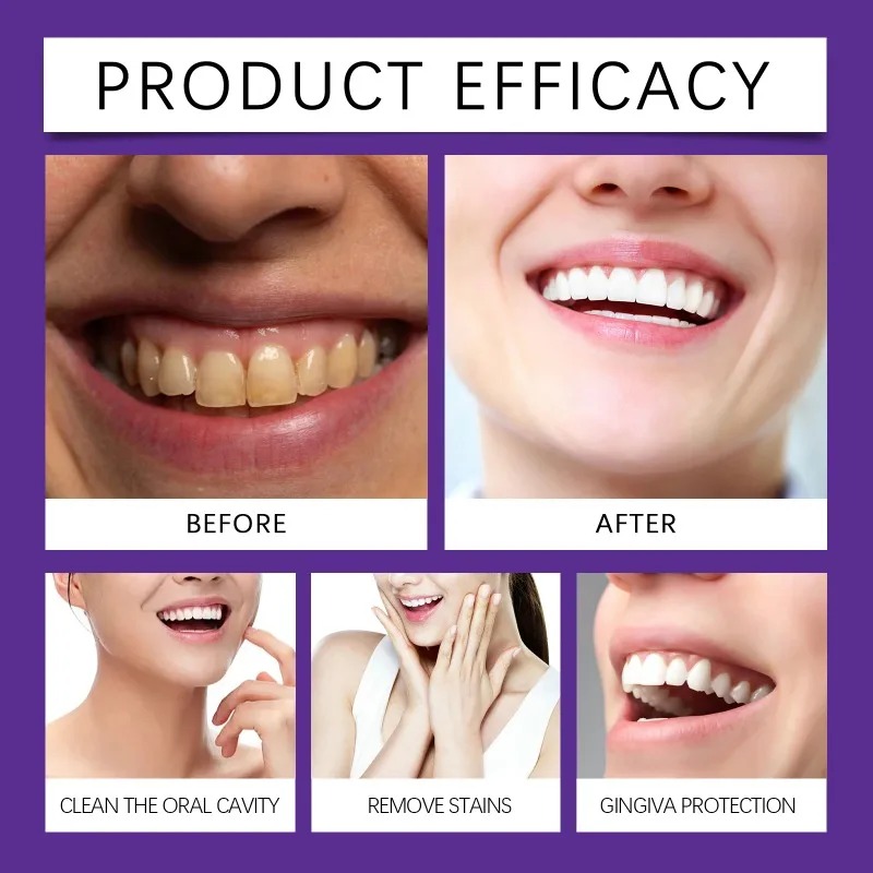 Poudre Minérale Violette pour  - Teeth Whitening Near Me avis et prix