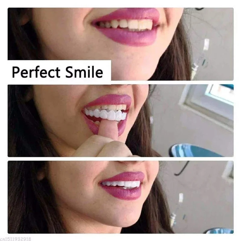 Kit de dents en placage à clip - Teeth Whitening Kit avis et prix